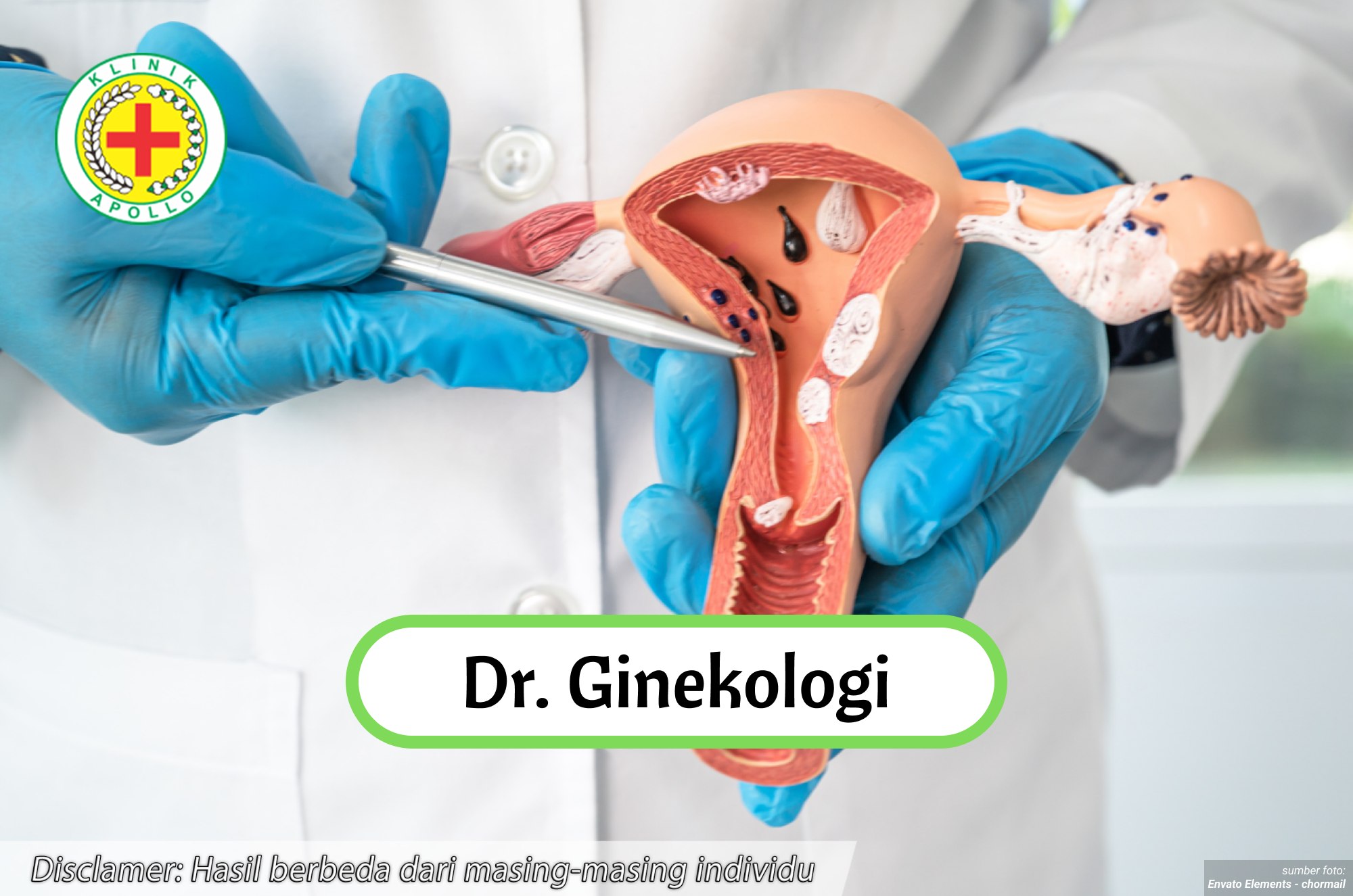 Ilustrasi dr. Ginekologi.