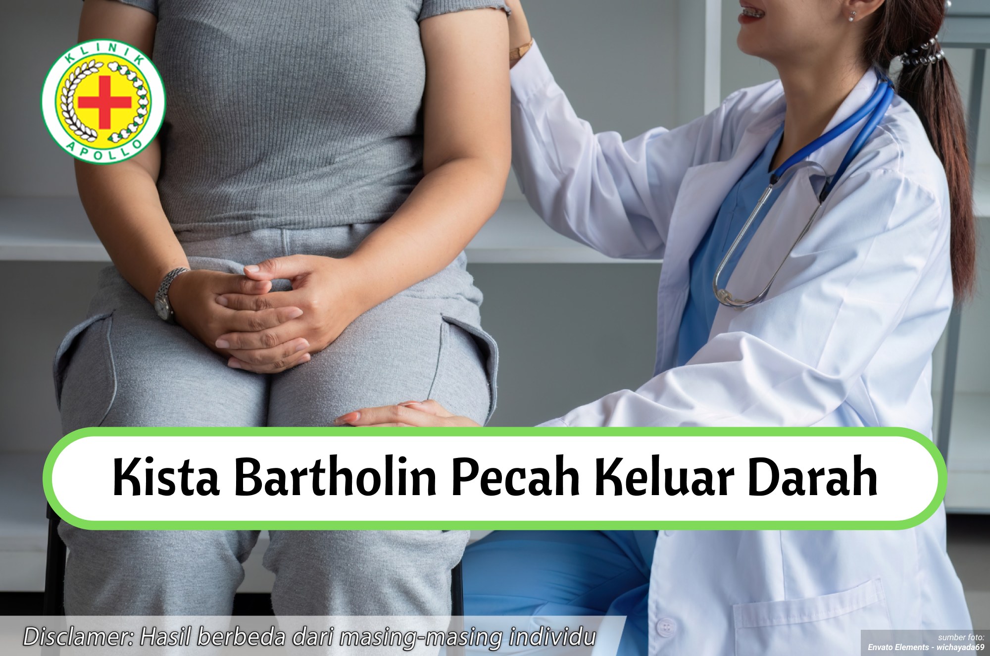 Ilustrasi Kista Bartholin Pecah Keluar Darah.