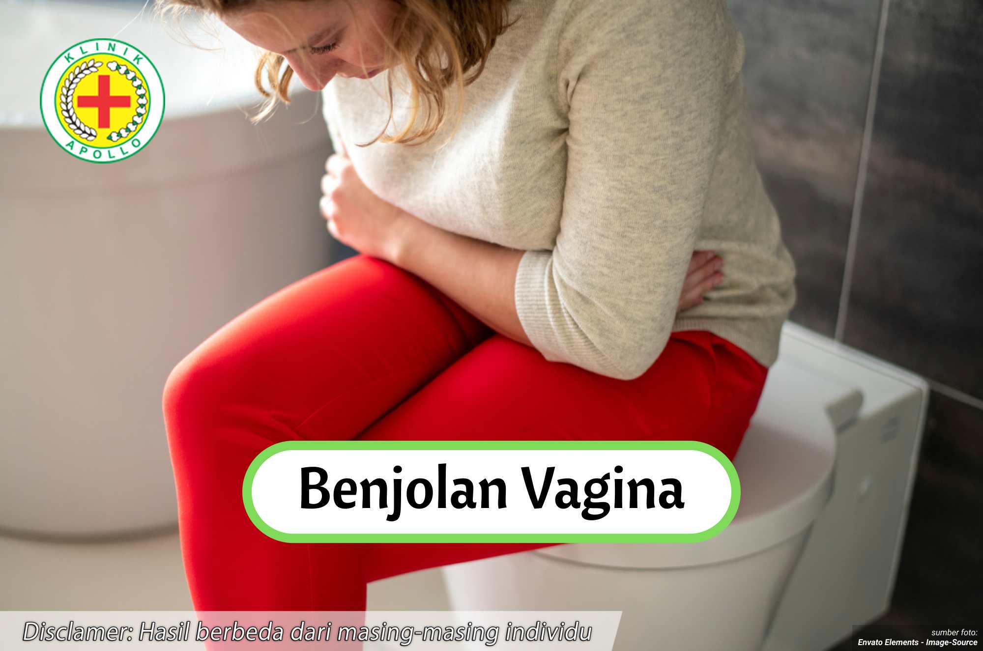 Ilustrasi Benjolan Vagina.