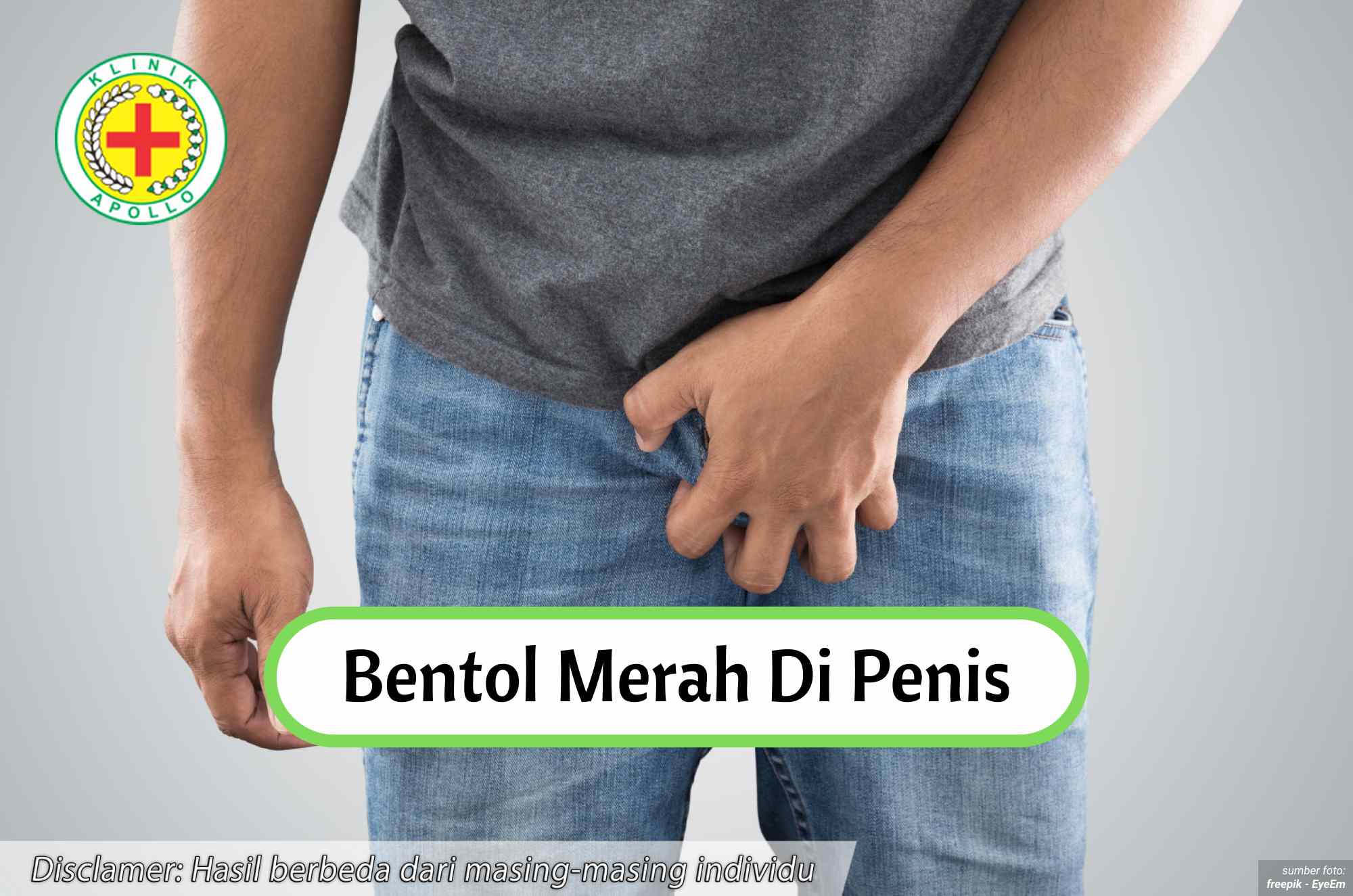 Ilustrasi Bentol Merah di Penis.
