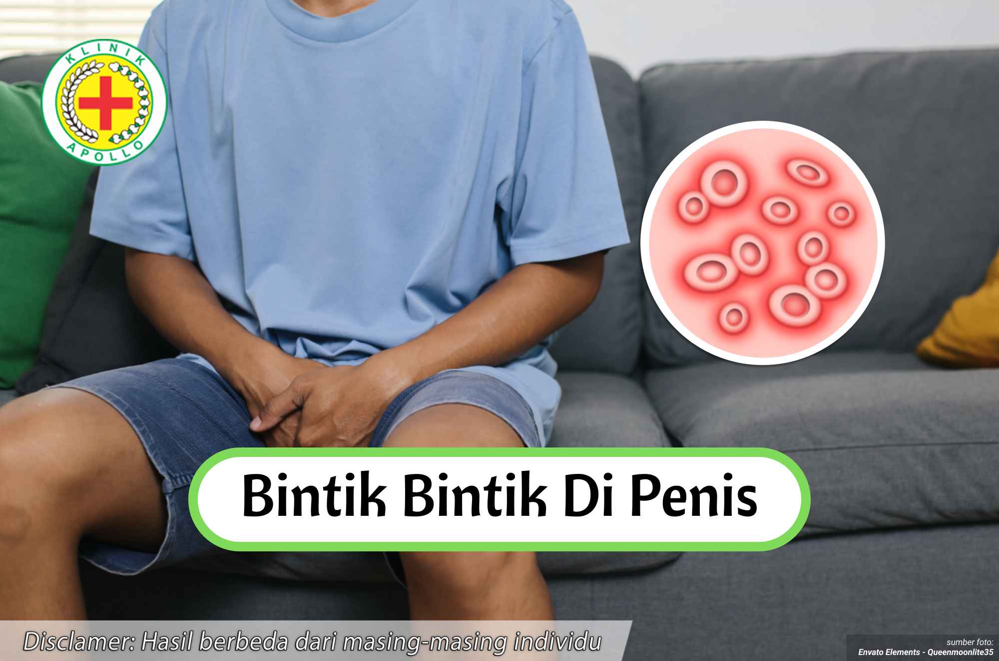 Ilustrasi Bintik bintik di Penis.