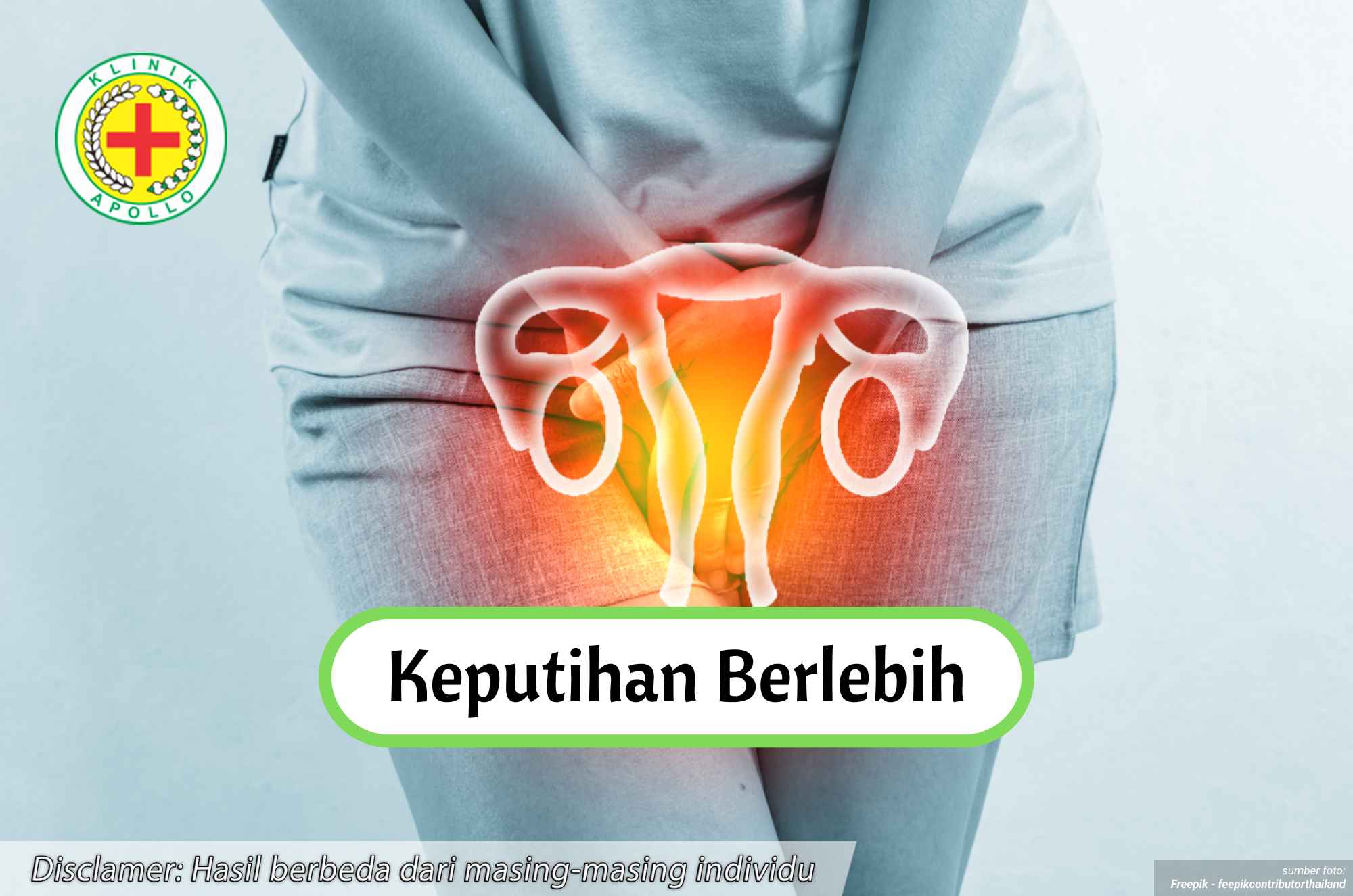 Ilustrasi Keputihan Berlebih.