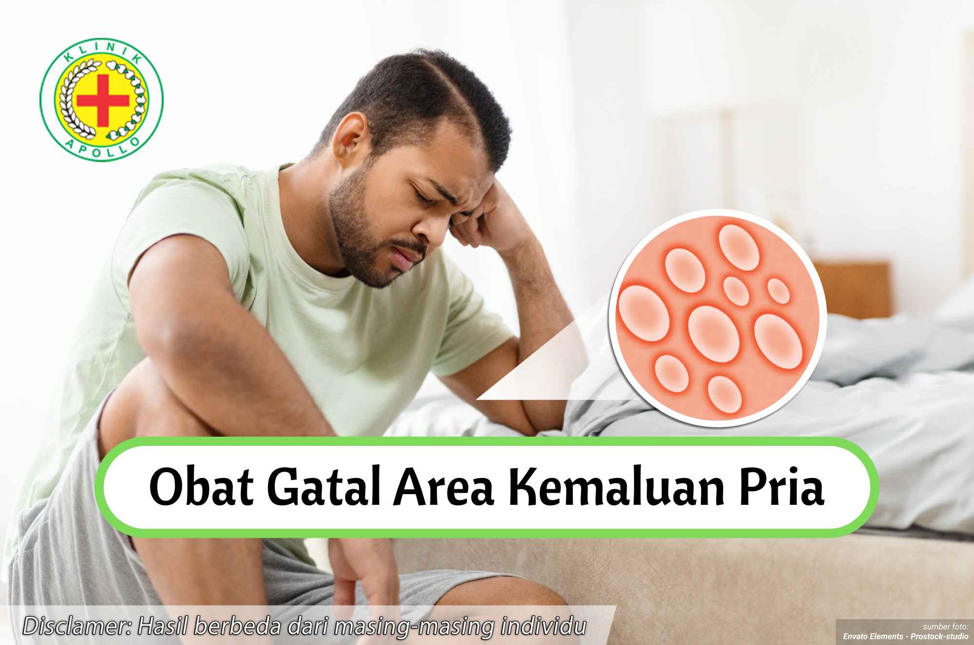 Ilustrasi Obat Gatal Area Kemaluan.