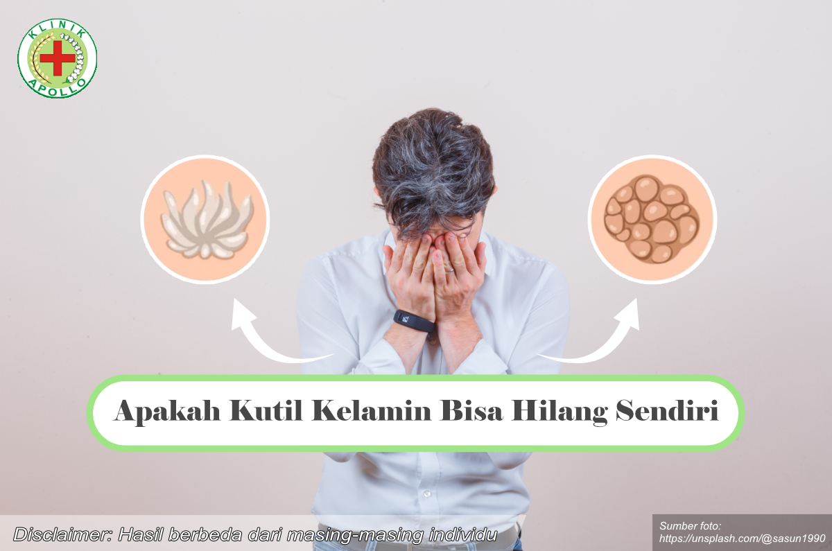 Ilustrasi Apakah Kutil Kelamin Bisa Hilang Sendiri.