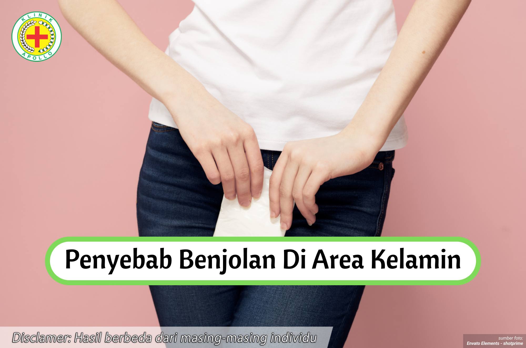 Ilustrasi Penyebab Benjolan di Area Kelamin.