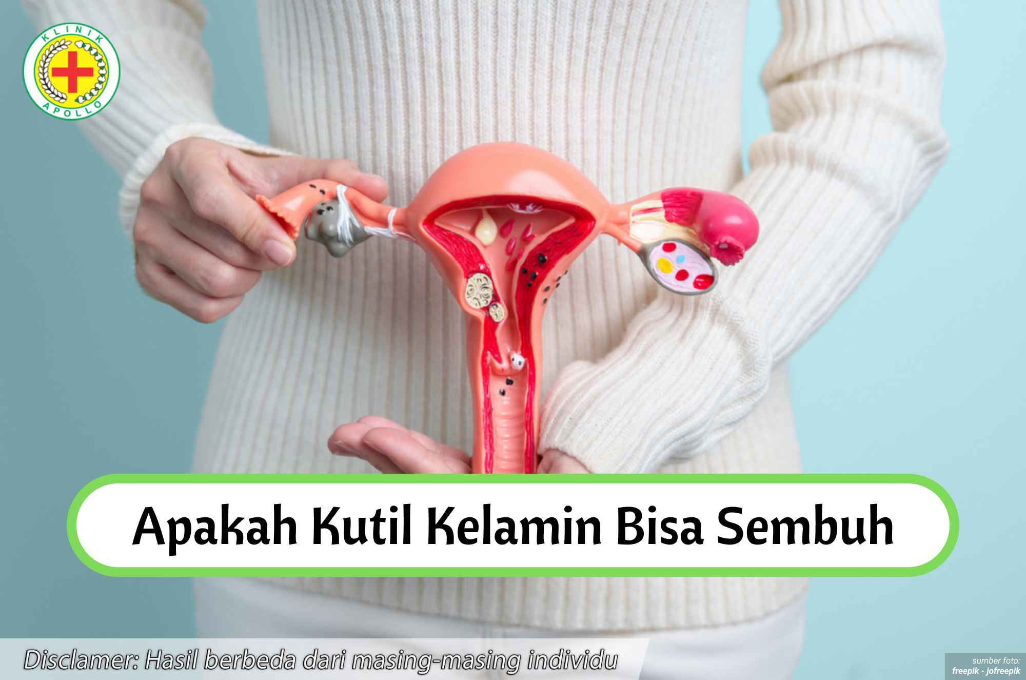 Ilustrasi Apakah Kutil Kelamin Bisa Sembuh.