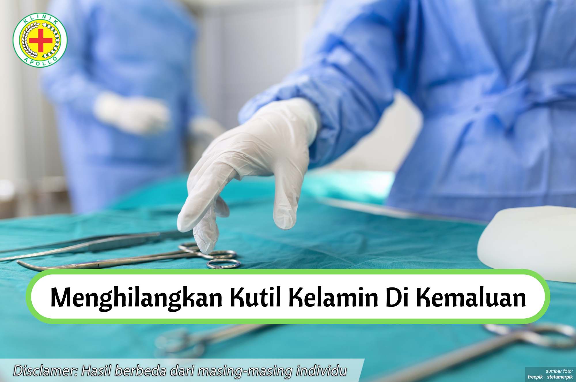 Ilustrasi Menghilangkan Kutil Kelamin di Kemaluan.