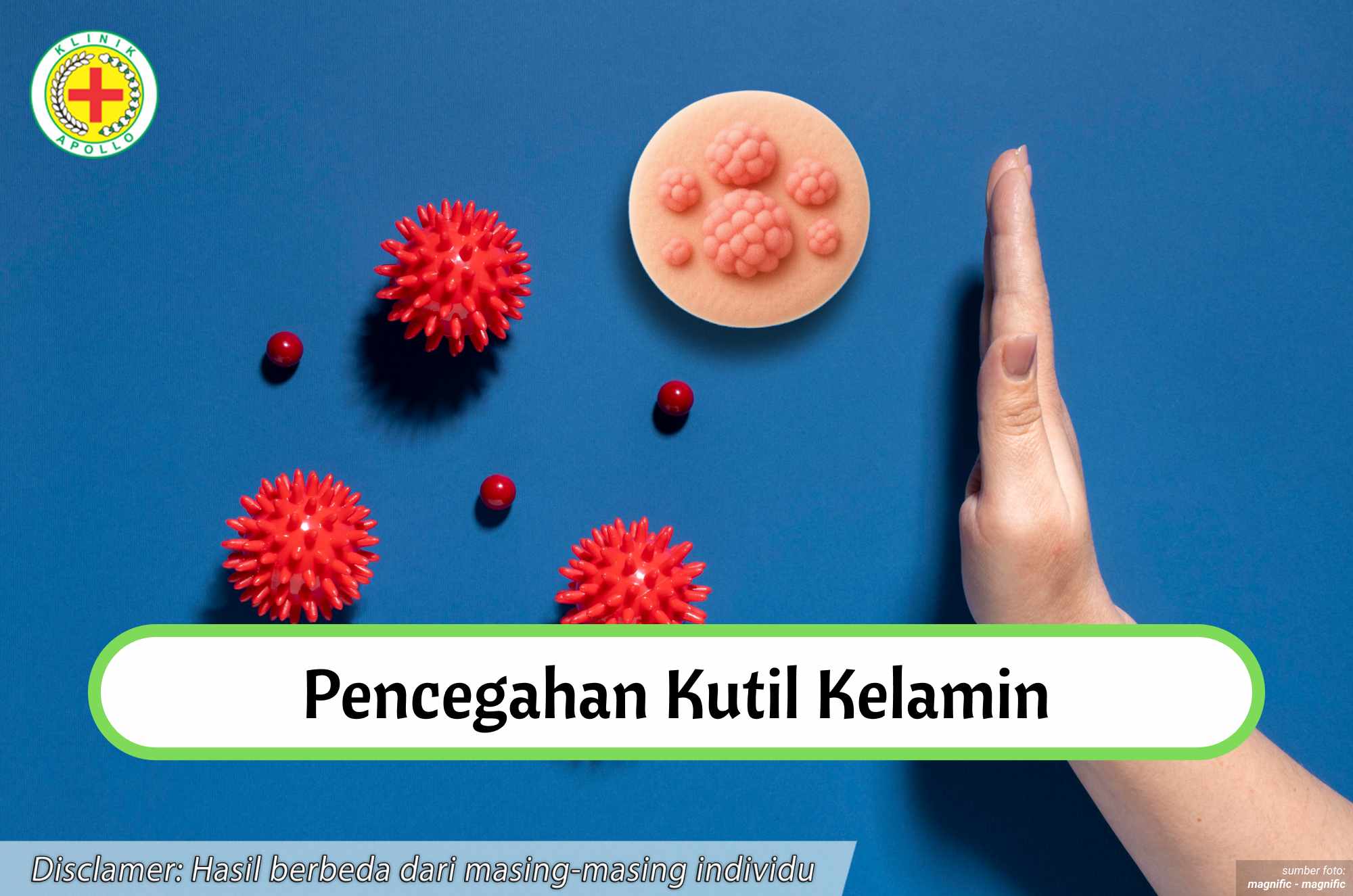 Ilustrasi Pencegahan Kutil Kelamin.
