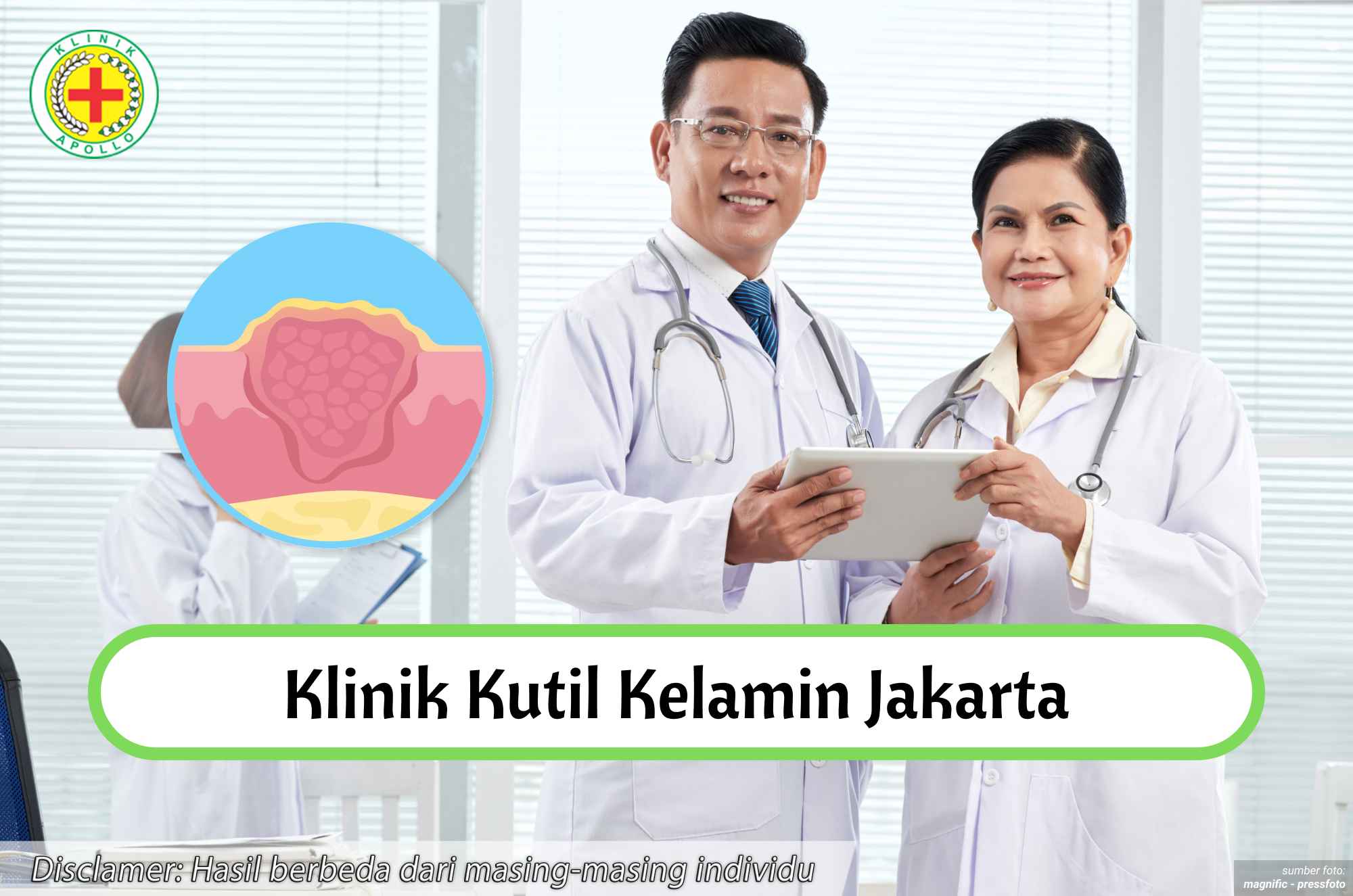 Ilustrasi Klinik Kutil Kelamin Jakarta.
