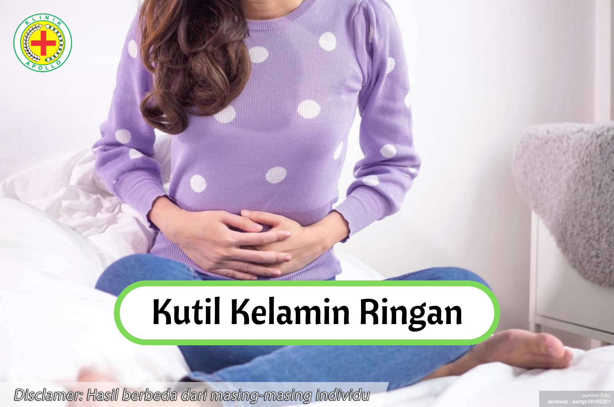 Ilustrasi Kutil Kelamin Ringan.