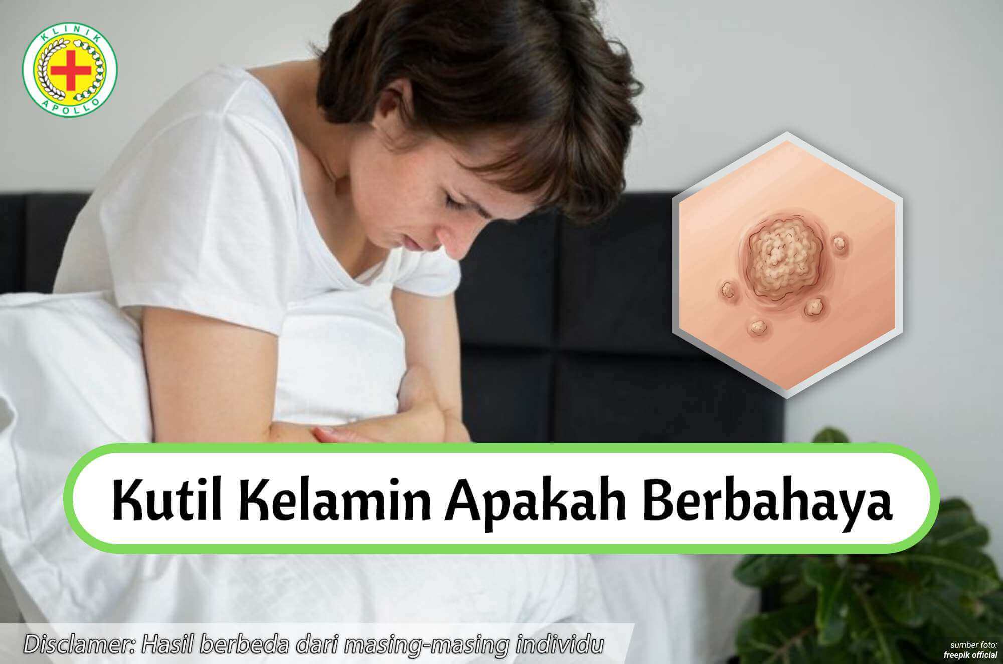 kutil kelamin apakah berbahaya