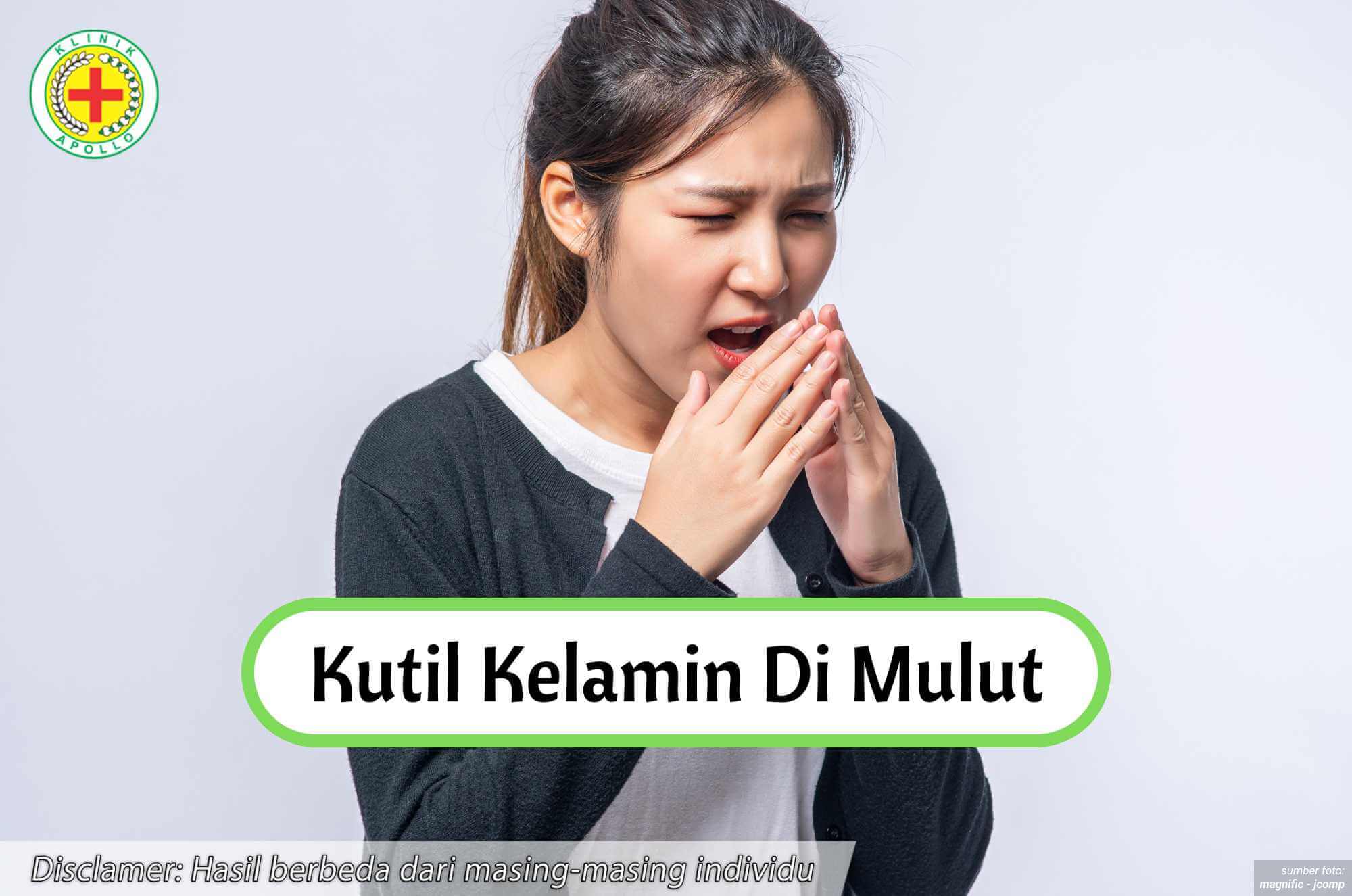 kenali kutil kelamin di mulut