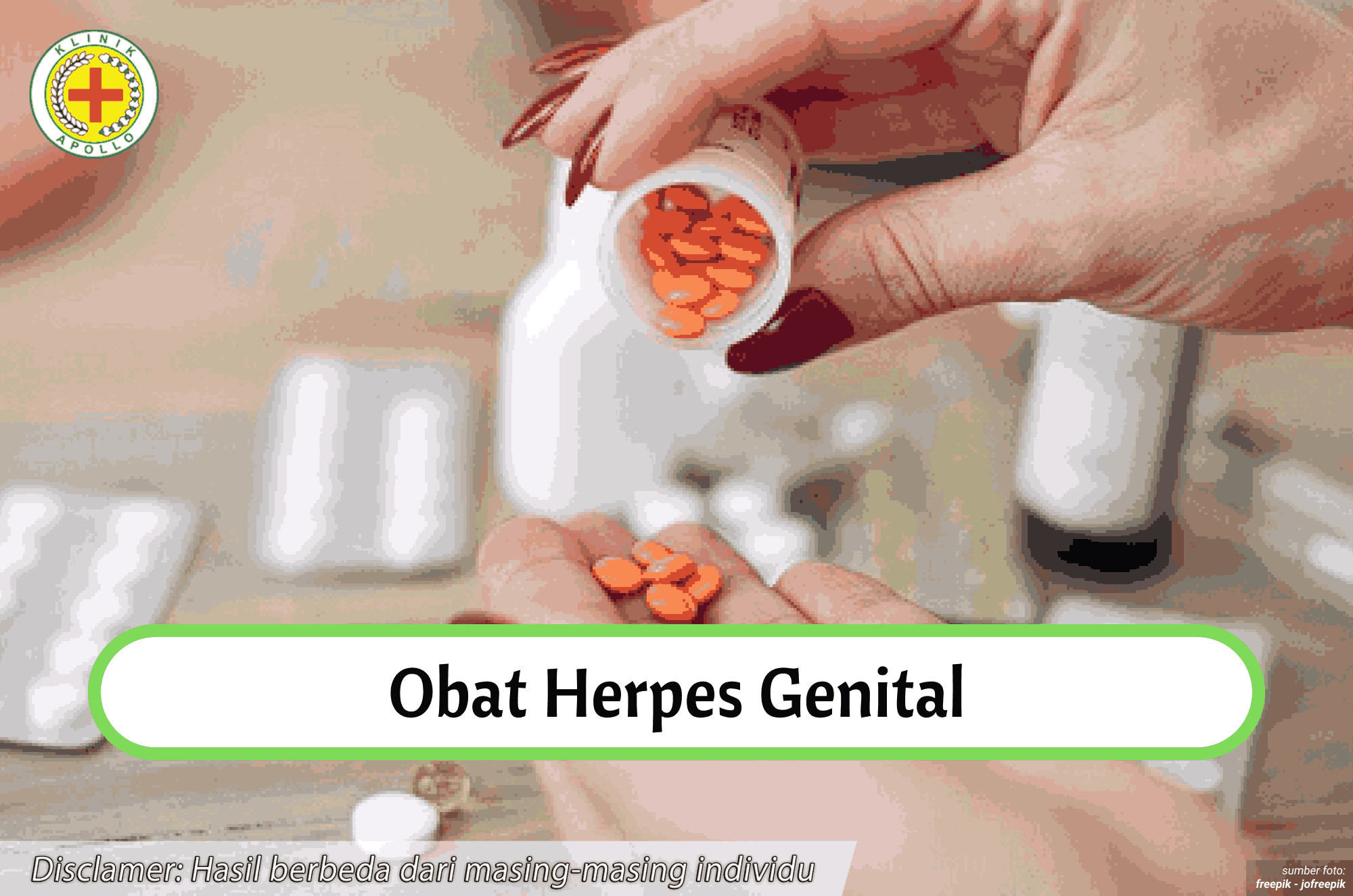 Ilustrasi Obat Herpes Genital.