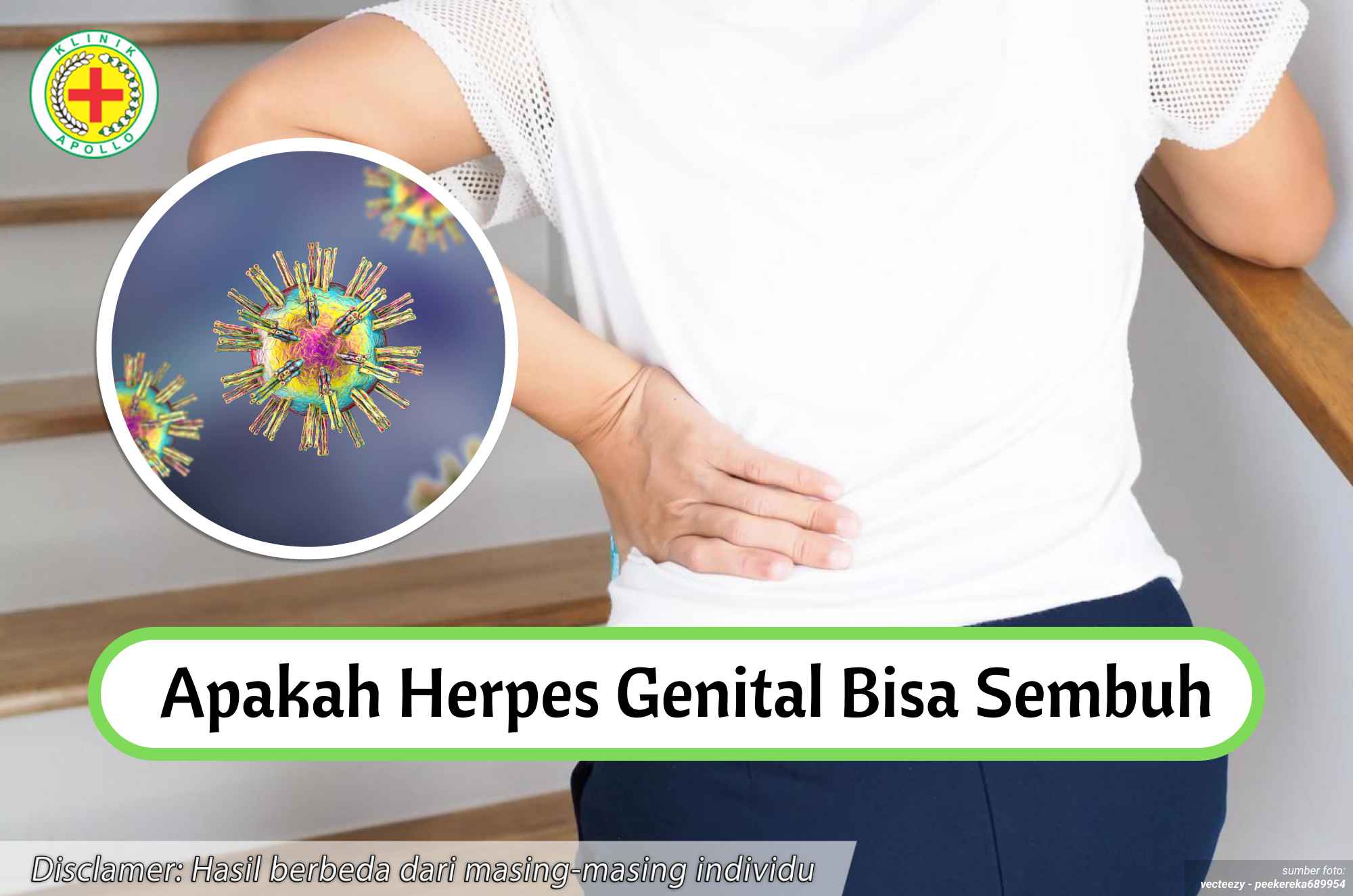 Ilustrasi Apakah Herpes Genital Bisa Sembuh.