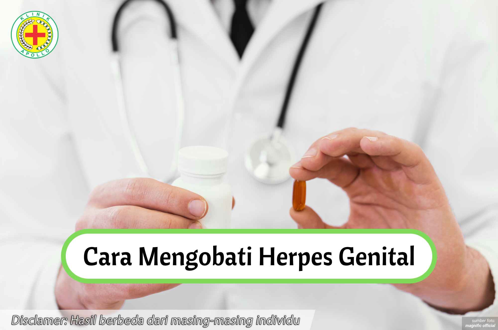 Ilustrasi Cara Mengobati Herpes Gental.