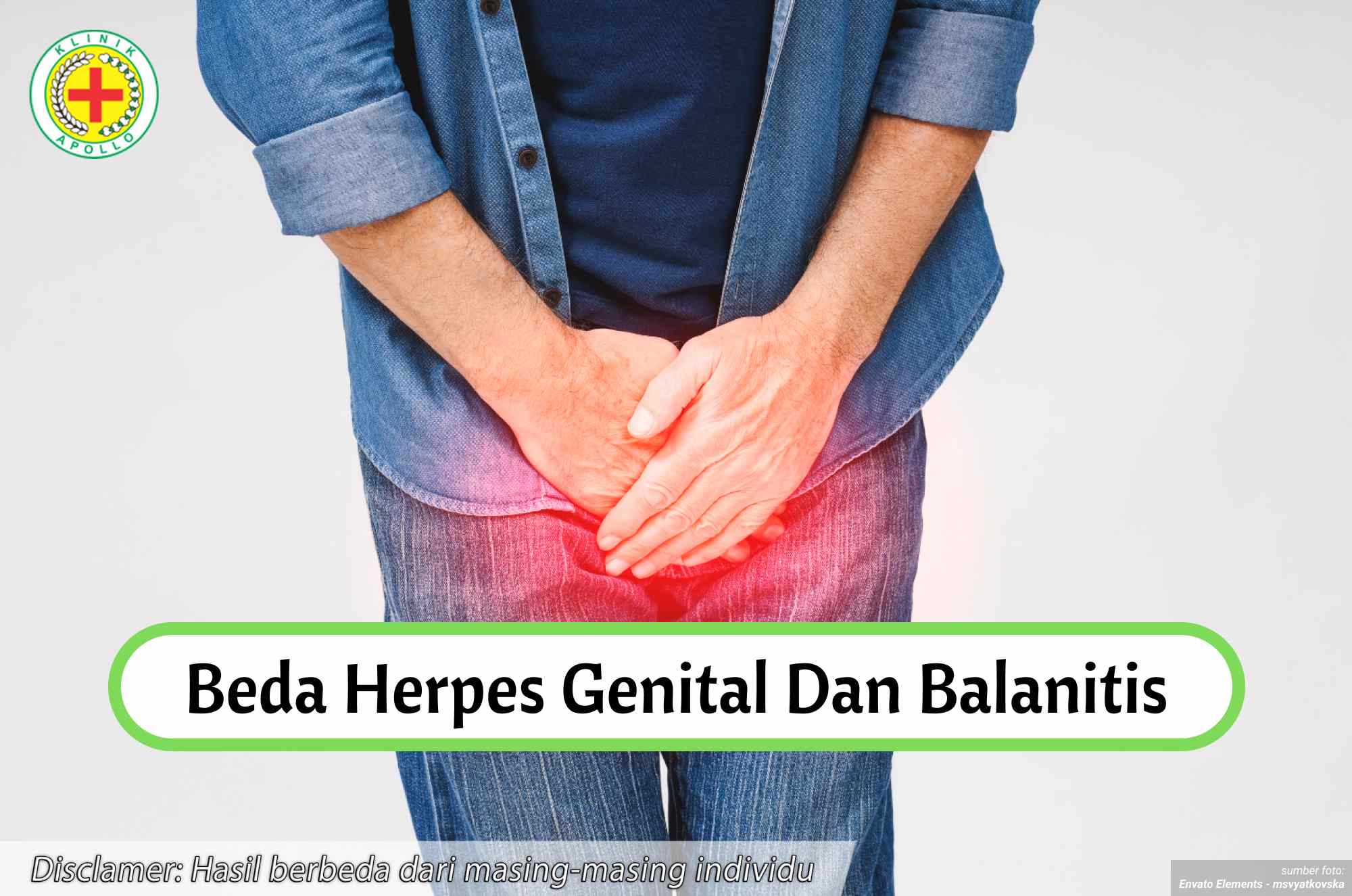 Ilustrasi Perbedaan Herpes Genital dan Balanitis.