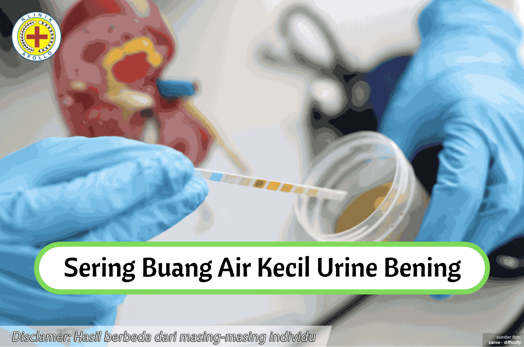 Ilustras Sering Buang Air Kecil Urine Bening.